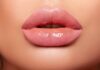 Увеличение губ филлерами – особенности введения