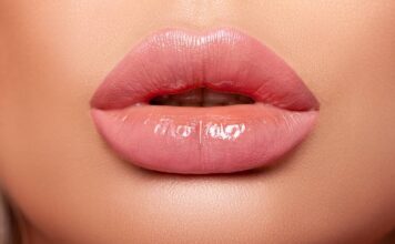 Увеличение губ филлерами – особенности введения