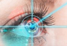 Процедура лазерной коррекции зрения: этапы